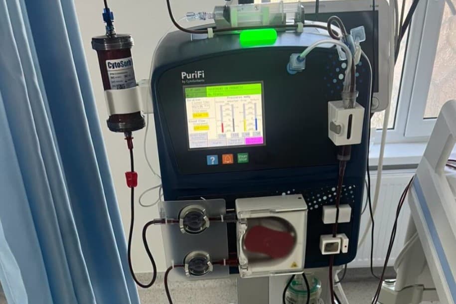 O tehnologie de filtrare a sângelui, utilizată în premieră în Republica Moldova