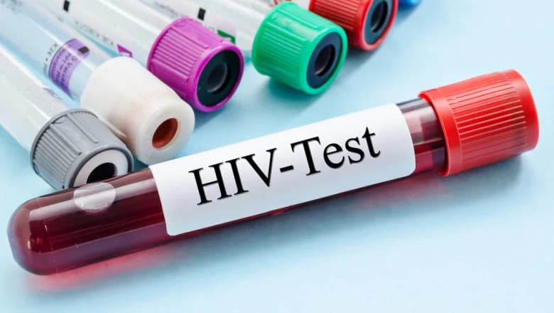 Epidemie generalizată de HIV în zeci de regiuni din Rusia. Cauzele care stau în spatele răspândirii scăpate de sub control